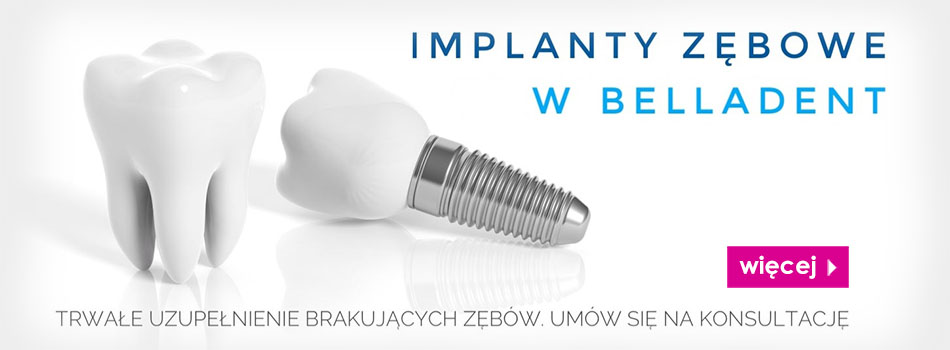 implanty_zebowe