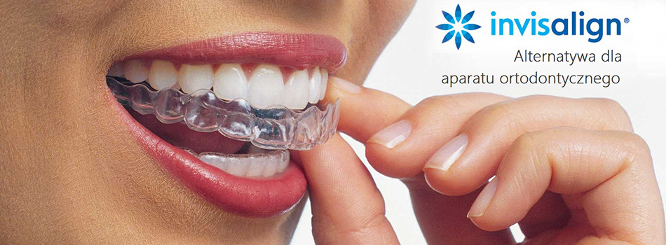 invisalign